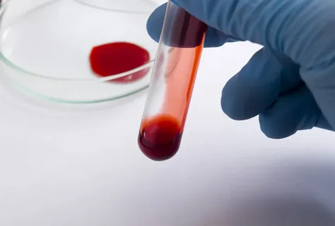 blood analysis melbourne, live blood analysis Melbourne